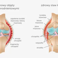Ból kolan do jakiego lekarza? Sprawdź, kogo potrzebujesz!