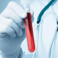 Co to jest HGB w badaniu krwi i dlaczego jest tak ważne dla zdrowia