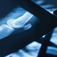 Czy fizjoterapeuta może wystawić skierowanie na rezonans? Sprawdź!