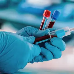 Co oznacza bazofile w badaniu krwi i co mogą ujawniać o zdrowiu