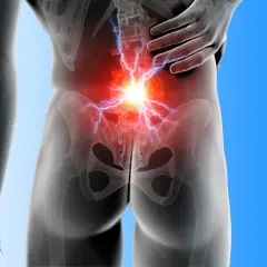 Anatomia bólu w dolnej części pleców i pośladku, z błyskawicami bólu.