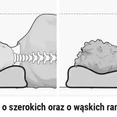 Skręcenie karku objawy: Jak rozpoznać i uniknąć bólu szyi