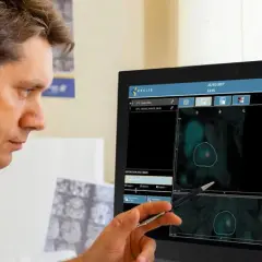 Ile kosztuje biopsja fuzyjna prostaty? Poznaj ceny i opcje finansowe