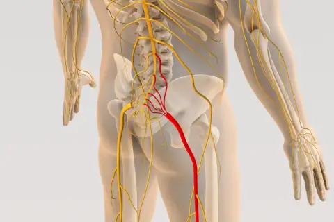 Anatomia układu nerwowego człowieka z zaznaczonym na czerwono nerwem biegnącym od kręgosłupa do nogi.