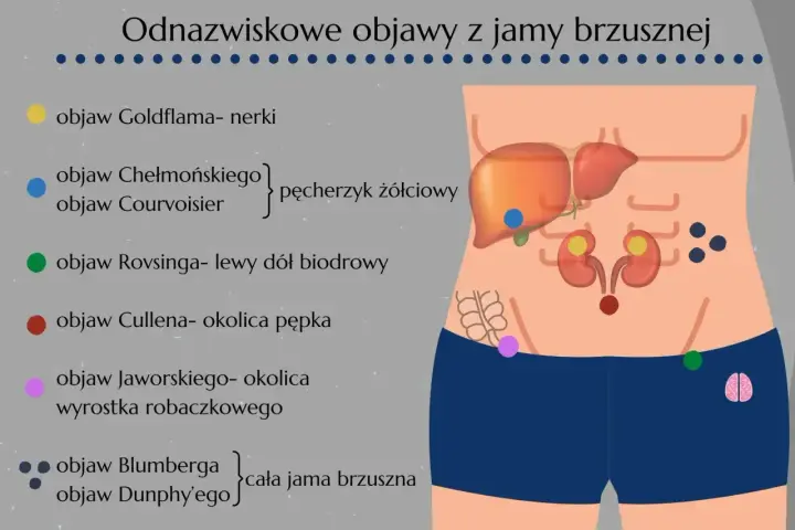 Ilustracja przedstawia schemat jamy brzusznej z zaznaczonymi punktami i opisami objawów chorobowych.
