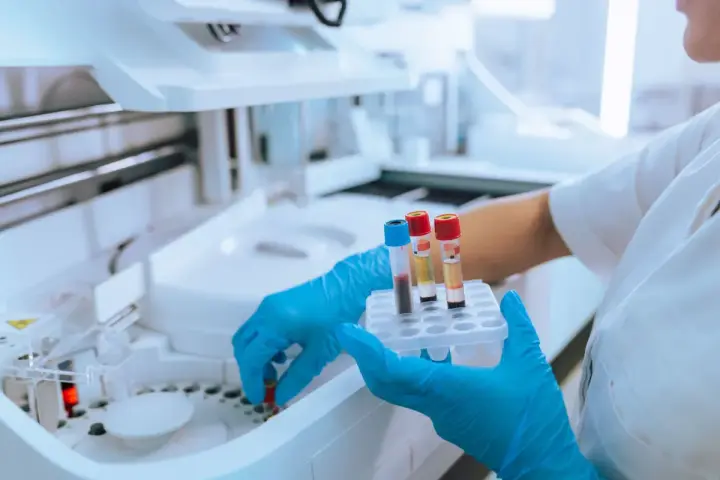Ręce w niebieskich rękawiczkach trzymają probówki z krwią przy aparaturze laboratoryjnej.