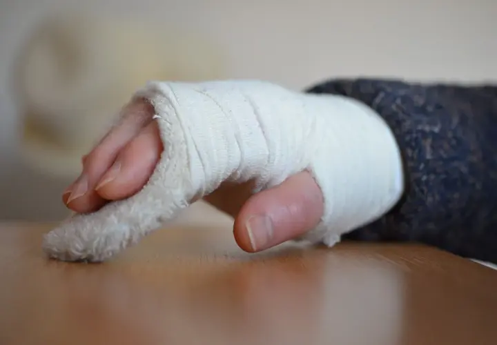 Jak długo trwa rehabilitacja po złamaniu nadgarstka? Poznaj fakty i czas powrotu do zdrowia