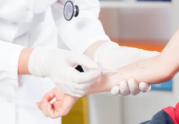 Lekarz w białej rękawiczce wykonuje test skórny na przedramieniu pacjenta.