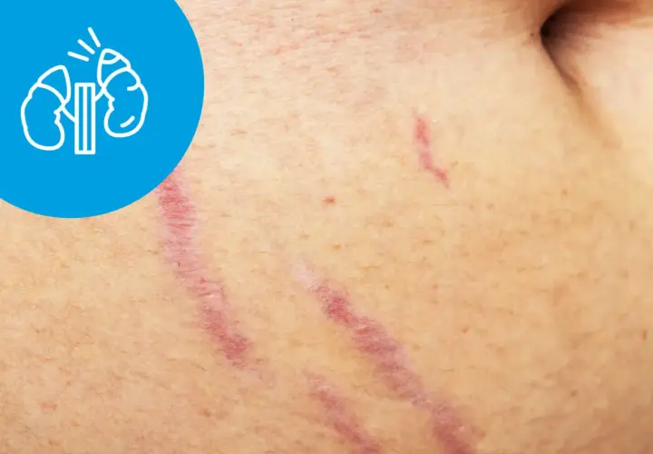 Zespół Cushinga – jakie badania potwierdzą diagnozę i co warto wiedzieć