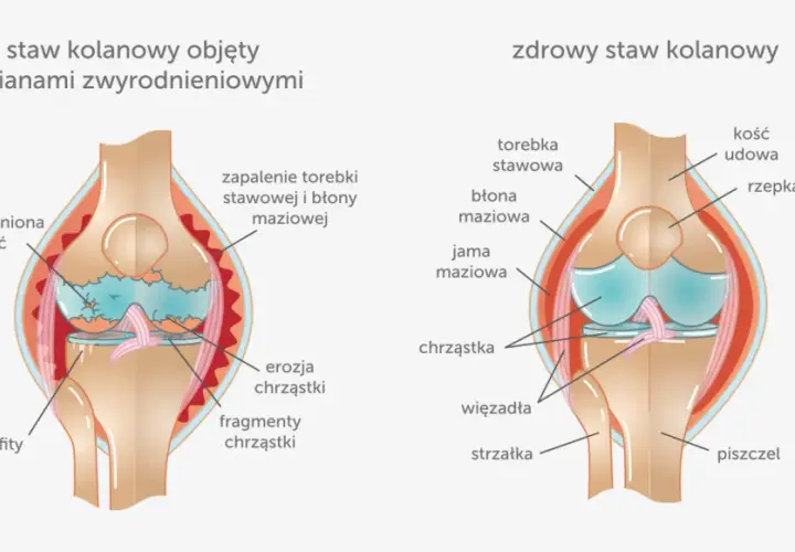 Ból kolan do jakiego lekarza? Sprawdź, kogo potrzebujesz!
