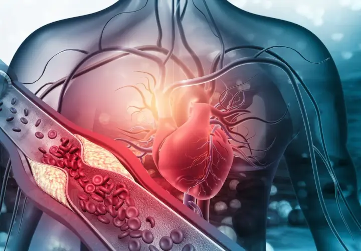 Anatomical illustration of a human torso showing a red heart and a cross-section of an artery with plaque buildup and red blood cells.