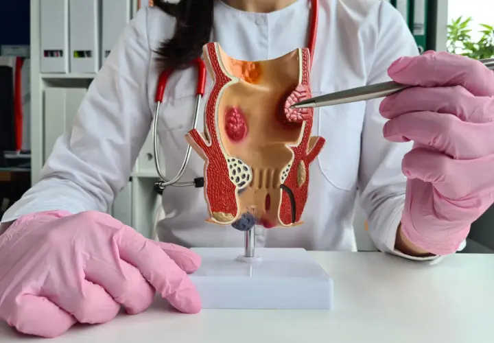 Choroba odbytu jaki lekarz? Dowiedz się, kiedy iść do proktologa