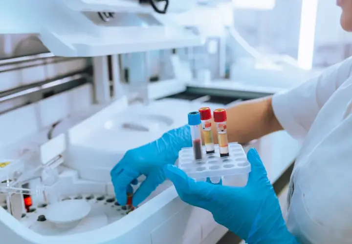 Ręce w niebieskich rękawiczkach trzymają probówki z krwią przy aparaturze laboratoryjnej.