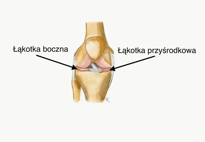 Ilustracja anatomiczna stawu kolanowego z zaznaczonymi łakotkami przyśrodkową i boczną.