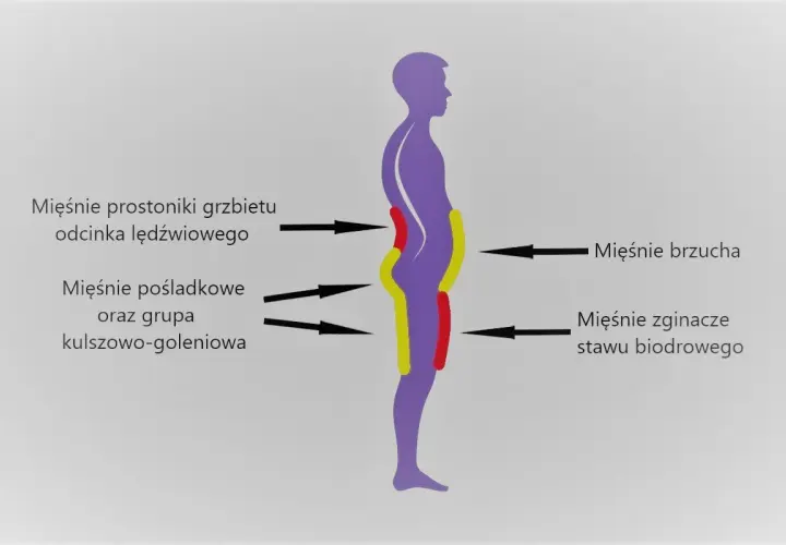 Sylwetka człowieka z zaznaczonymi obszarami mięśni: prostowników grzbietu, pośladkowych, brzucha i zginaczy stawu biodrowego.