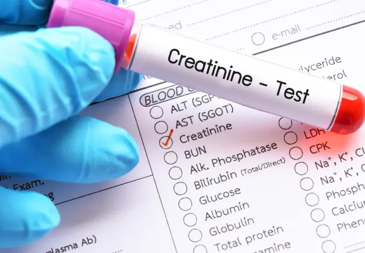 Ręka w niebieskiej rękawiczce trzyma probówkę z napisem "Creatinine - Test" nad formularzem badań.