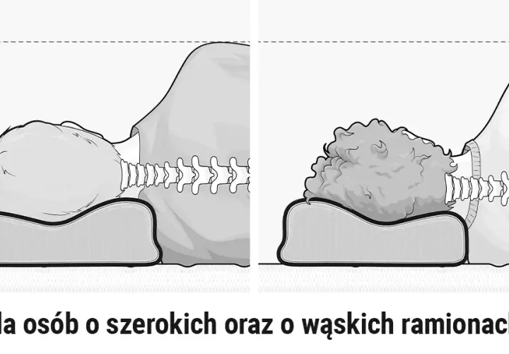 Skręcenie karku objawy: Jak rozpoznać i uniknąć bólu szyi