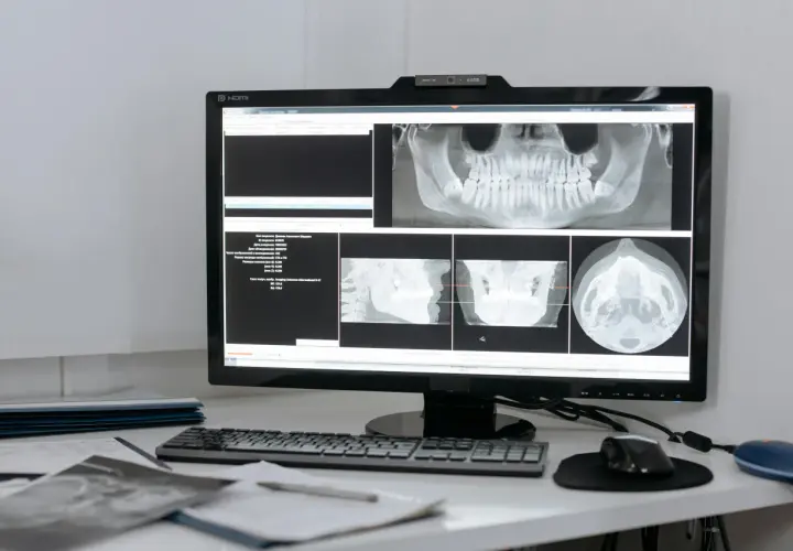 Teleradiologia – jakie korzyści daje placówkom medycznym?