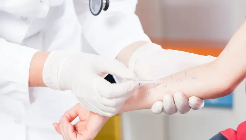 Lekarz w białej rękawiczce wykonuje test skórny na przedramieniu pacjenta.