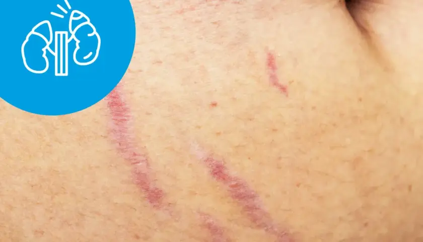 Zespół Cushinga – jakie badania potwierdzą diagnozę i co warto wiedzieć
