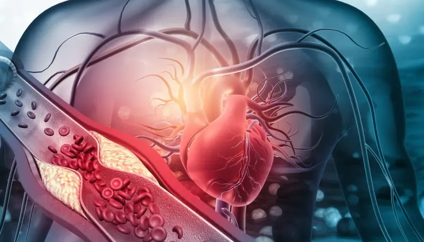 Anatomical illustration of a human torso showing a red heart and a cross-section of an artery with plaque buildup and red blood cells.
