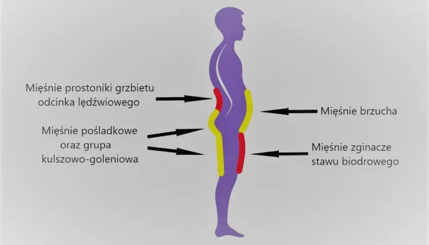 Sylwetka człowieka z zaznaczonymi obszarami mięśni: prostowników grzbietu, pośladkowych, brzucha i zginaczy stawu biodrowego.