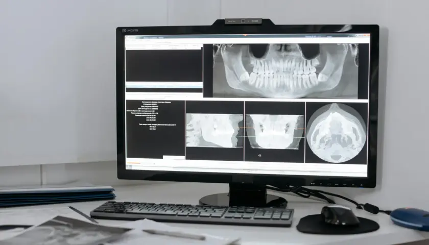 Teleradiologia – jakie korzyści daje placówkom medycznym?