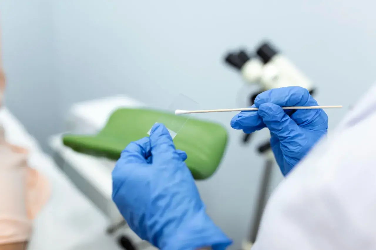 Ręce w niebieskich rękawiczkach przygotowują próbkę do badań cytologicznych. Wyniki będą gotowe wkrótce.